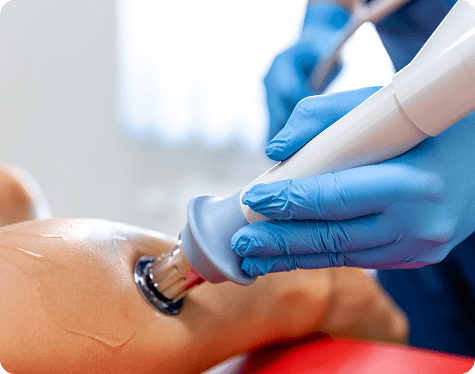 Vein treatment