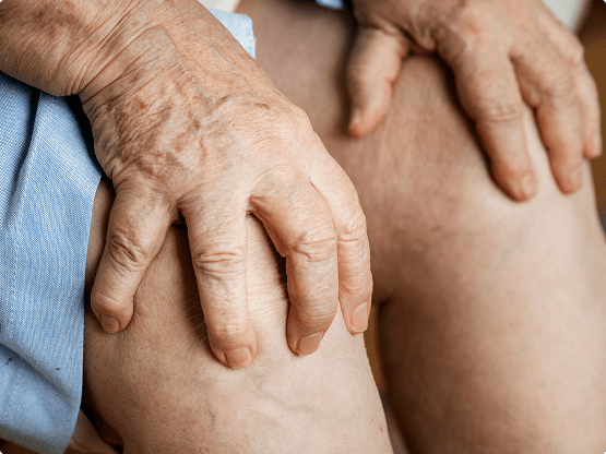 Vein knee photo