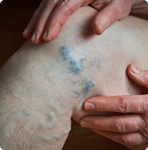 Why Early Treatment Matters